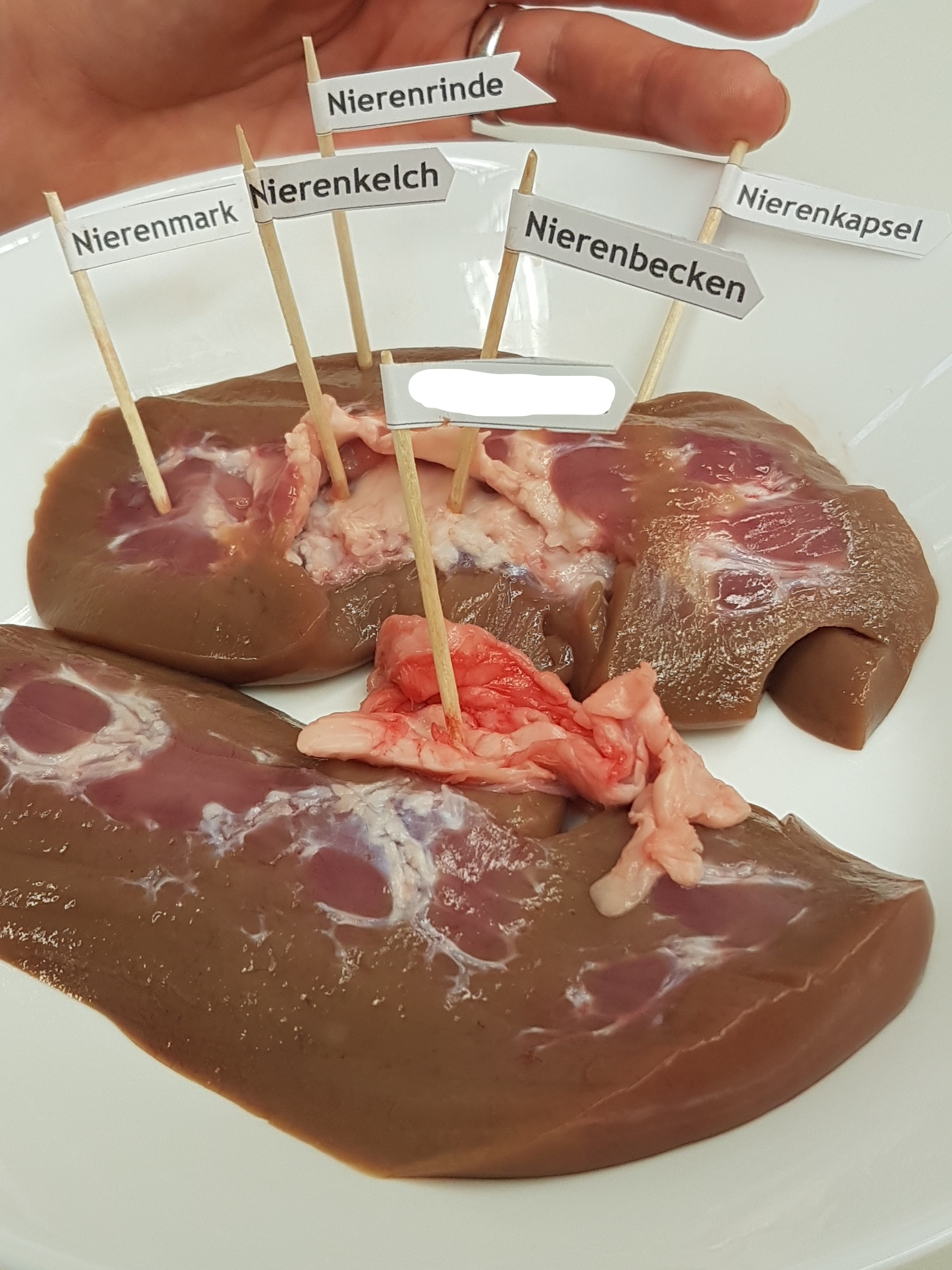 Anatomie für Altenpflegeschüler